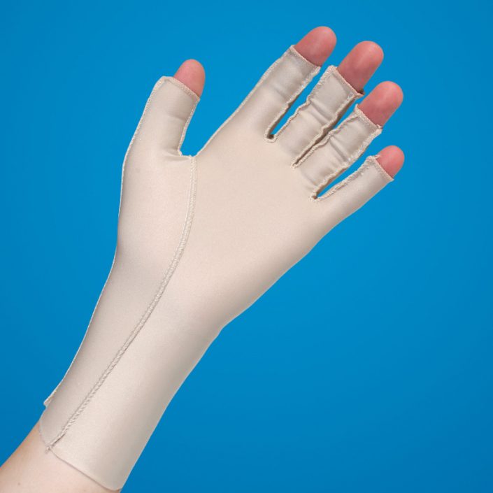 oedema glove for post trauma or stroke