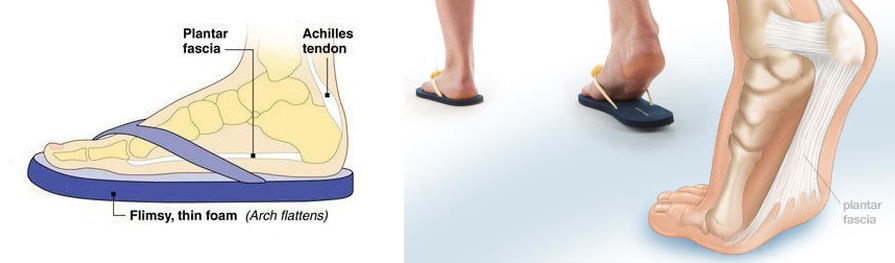 Can Flat Shoes Cause Ankle Pain? Exploring the Effects and Solutions